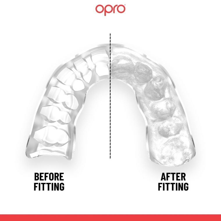 Opro Ochraniacz Na Zęby Instant Custom Fit Poland