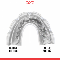 Opro Ochraniacz na Zęby Custom Fit Braces Czarny/Biały - sklep MMAniak.pl