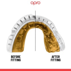 Opro Ochraniacz Na Zęby Gold Braces + Strap czarny