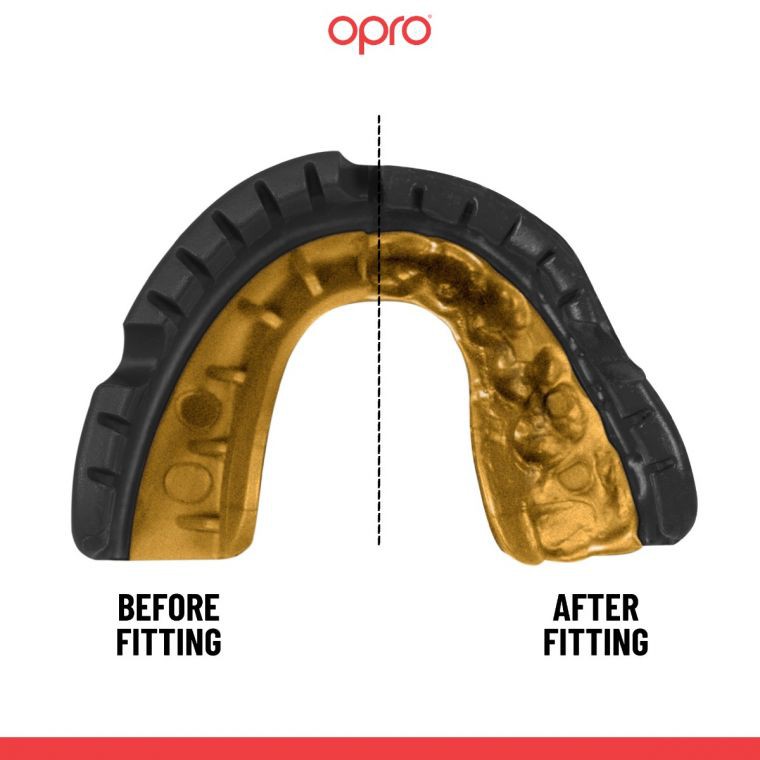 Opro Ochraniacz na Zęby Gold Braces GEN5 Czarny (do aparatów)