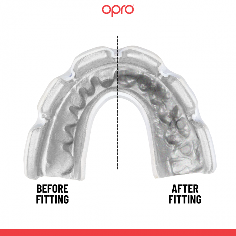Opro Ochraniacz Na Zęby Instant Custom Fit Czarny