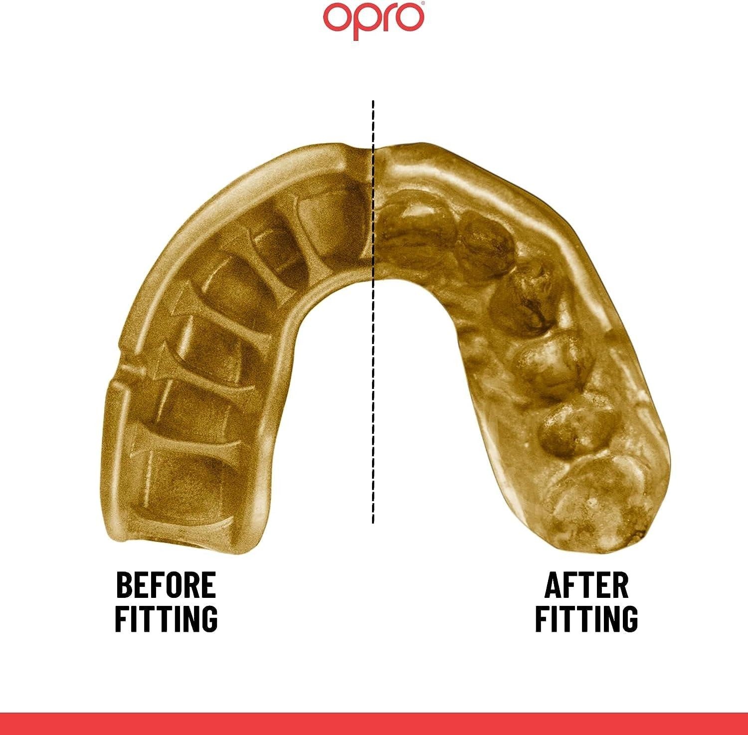 Opro Ochraniacz Na Zęby Dla Dzieci Gold + Strap Czarny/Złoty