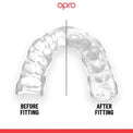 Opro Ochraniacz Na Zęby Instant Custom Fit Poland