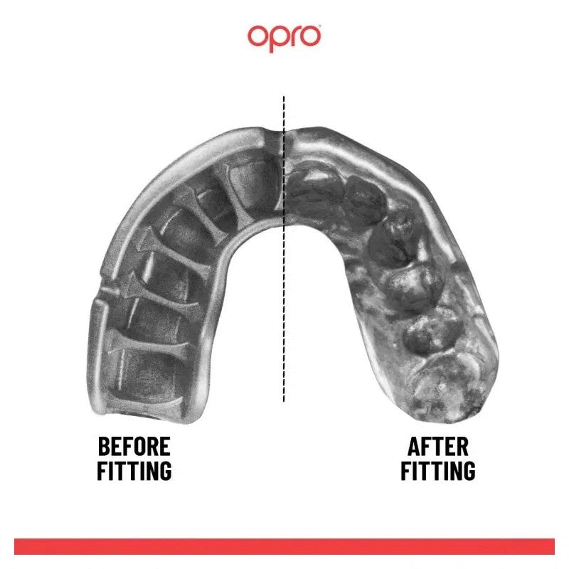 Opro Ochraniacz na Zęby Gold GEN5 Clear